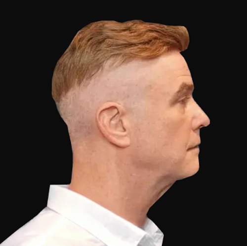 Patient result &mdash; before