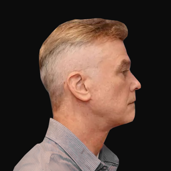 Patient result &mdash; after