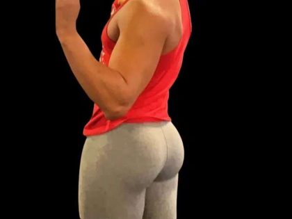 Brazilian Butt Lift Before & After Patient #365