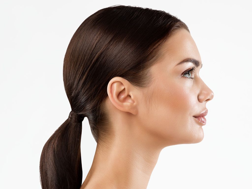 Rhinoplasty