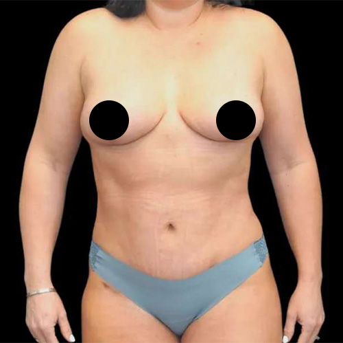 Patient result &mdash; after