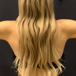 Arm Liposuction Before & After Patient #1590